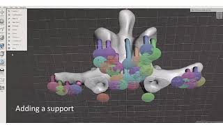 Triple modality 3D printed phantom of the lumbar spine for teaching interventional radiologists