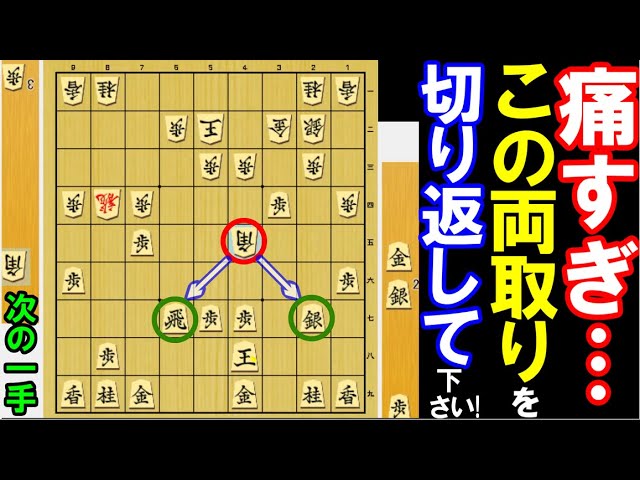 It hurts so much Please counter this rook and silver capture