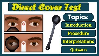 Direct Cover Test - Complete Tutorial