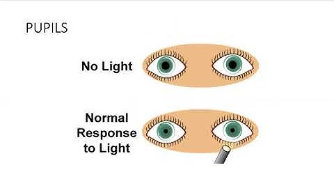 Clinical Assessment of Visual Function PART 1
