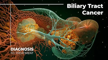 Unveiling the Mysteries of Biliary Tract Cancer: A Deep Dive into Cholangiocarcinoma