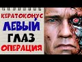 Клиника Арцыбашева | Кератоконус | Операция на моем левом глазу.