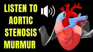 Doctor explains AORTIC STENOSIS, including real heart SOUNDS of the murmur.