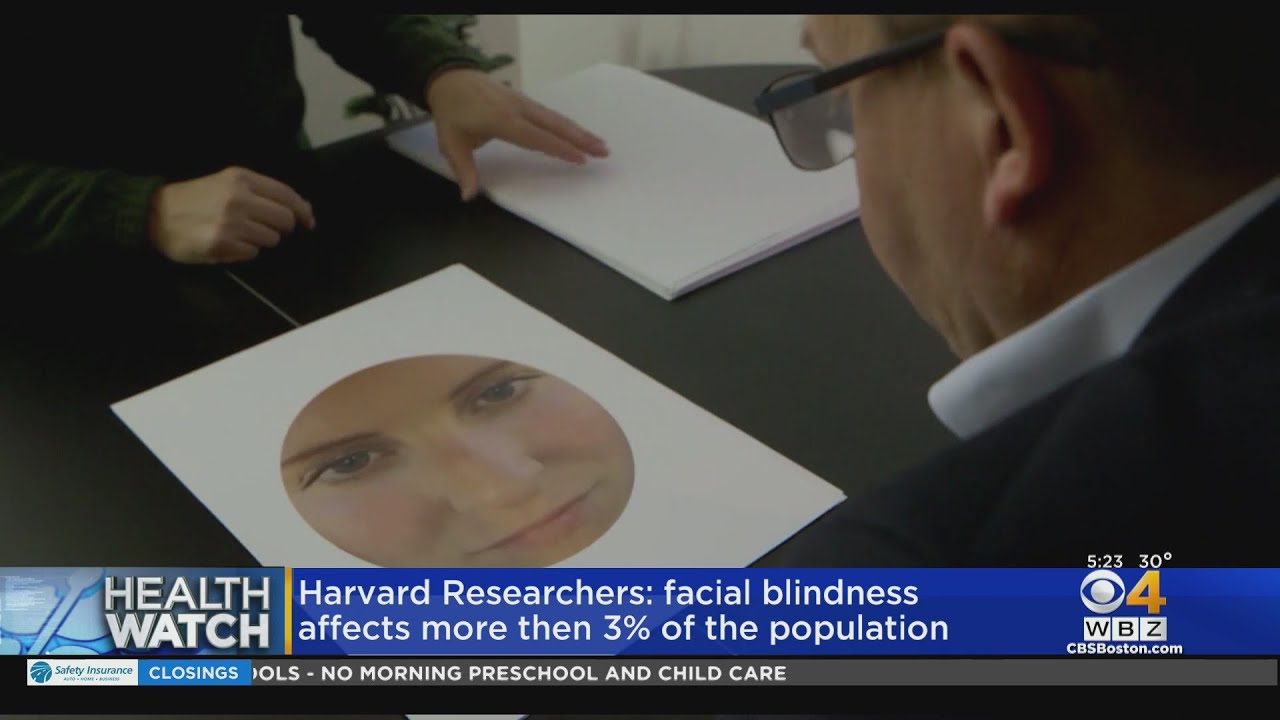 Facial blindness affects more than 3 of population, Harvard study
