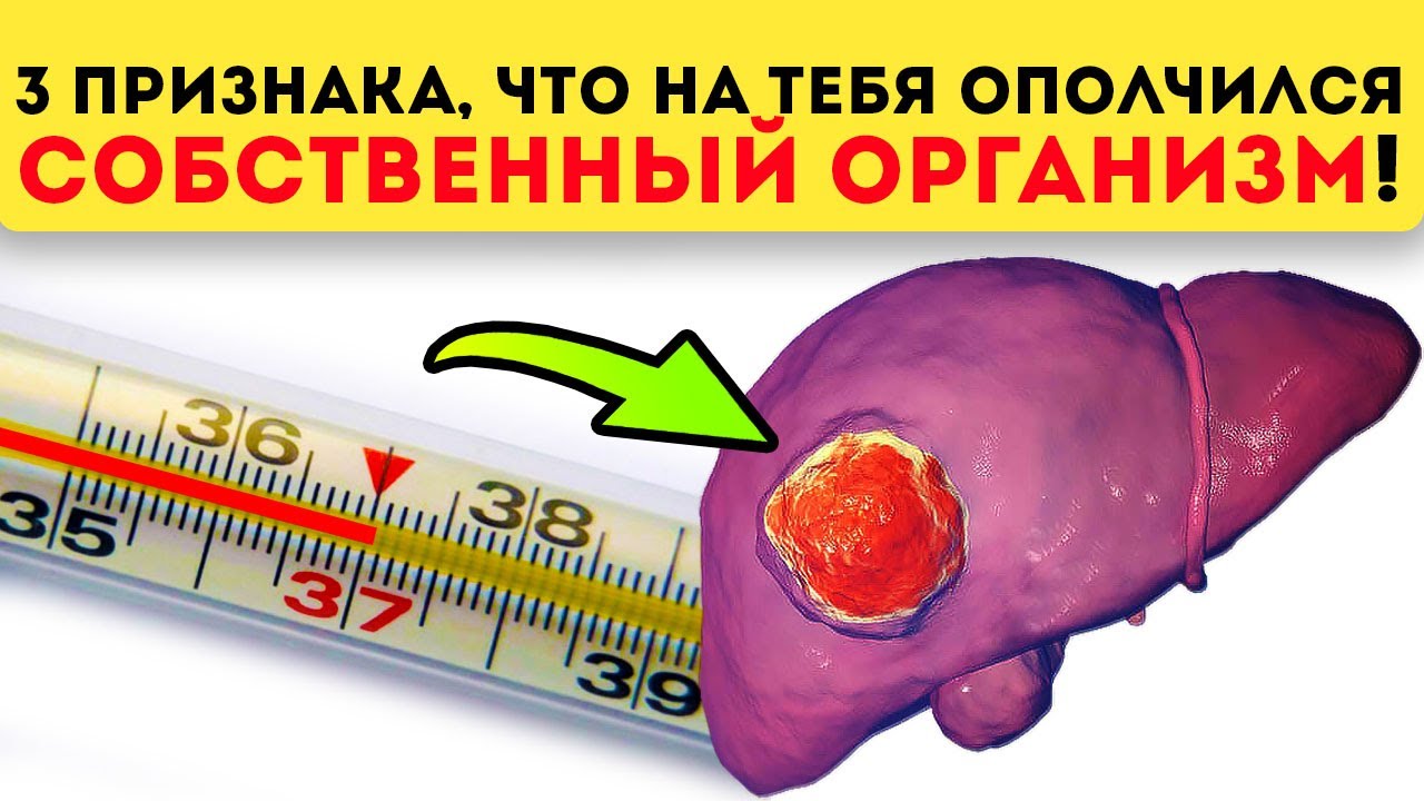 Проверь, нет ли тебя в этом списке: печень, псориаз, артрит, рассеянный склероз...