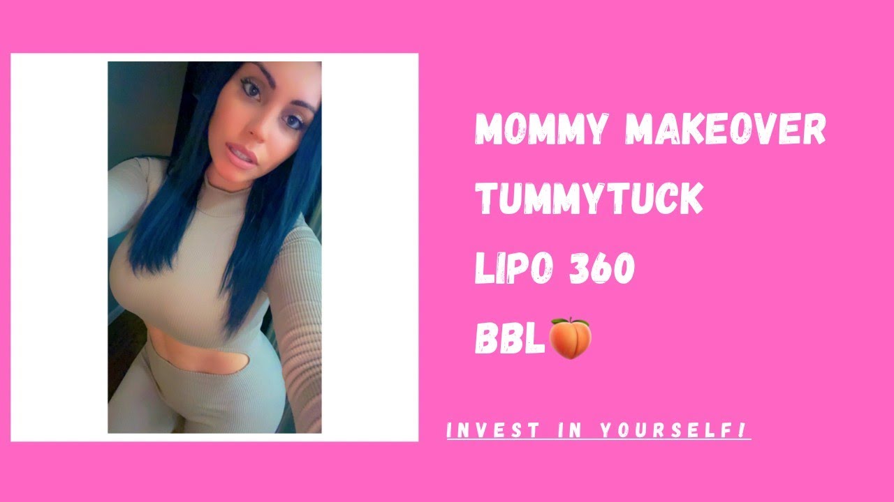 Mommy Makeover! Tummy Tuck Lipo 360 BBL! 7 Months Post Op Results and