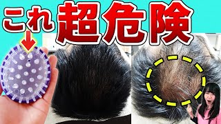 【発毛のプロに聞く】シャンプーブラシのメリット・デメリット～髪が生えるのに効果的な使い方と選び方～