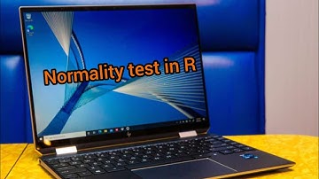 How to run normality test in R