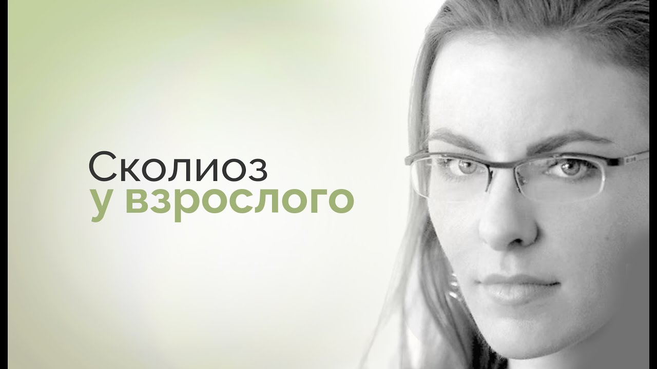 Сколиоз у взрослого человека: можно ли изменить угол? - YouTube