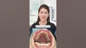 BẠN ĐÃ SẴN SÀNG THAY ĐỔI NỤ CƯỜI CÙNG NHA KHOA VNES?