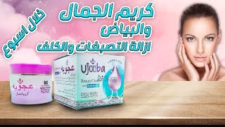 خلطة عجوبه الاصليه لتبيض الوجه خلال ٣ ايام والتخلص من البقع الداكنه وحب الشباب beauty cream ujooba