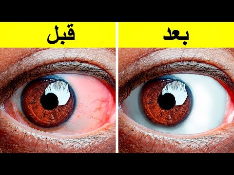 إليك 10+ تمارين سهلة لإراحة العيون المتعبة