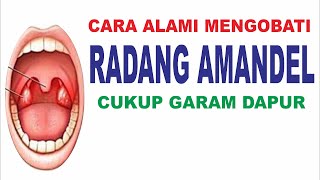Cara mengobati radang amandel secara alami!
