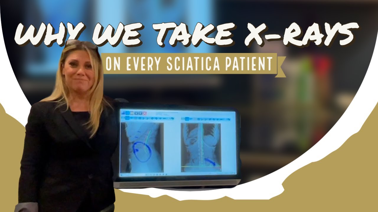 Why We Take X-rays On Every Sciatica Patient | Chiropractor for Sciatica in Ramsey, NJ