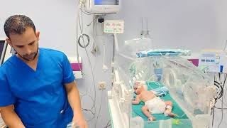 احتراف الحضانات تثبيت الطفل على جهاز تنفس صناعى وجهاز نصف تنفس صناعى