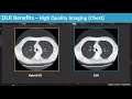 Increase Productivity and Clinical Decision Support through Deep Learning CT Image Processing