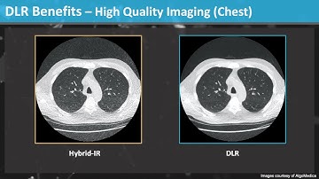 Increase Productivity and Clinical Decision Support through Deep Learning CT Image Processing