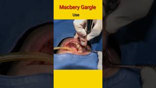 macbery gargle use in Hindi