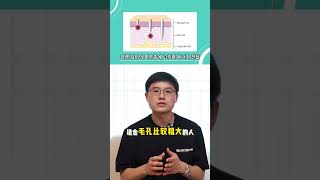 關於韓國POTEZA黃金射頻微針的最全整理！探頭，價錢，搭配藥物等 #shorts