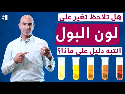 فيديو: ماذا يعني اللون الأصفر على سكايب؟