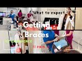 Getting braces |My Experience | Pain | What to expect.