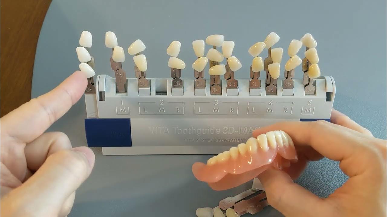 The whitest denture shades YouTube