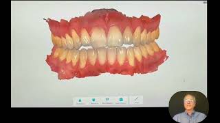 How Custom Dental Orthotics Are Made & Why They Work | TMJ & Bite Relief Explained