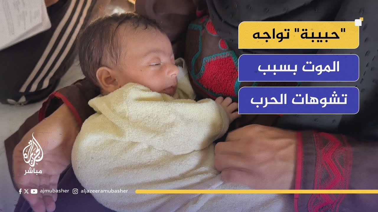 بسبب استنشاق البارود.. قصة ولادة "حبيبة" المشوّهة في خيمة النزوح