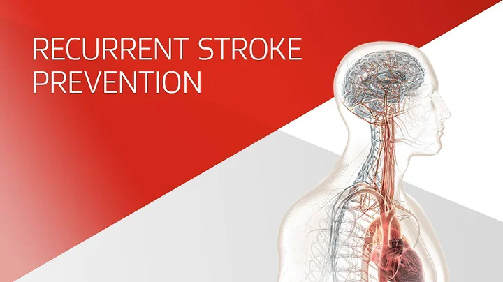 The case for PFO closure: Preventing recurrent stroke in cryptogenic stroke patients