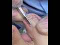 Gentle Toenail Trim | Relaxing Foot Care Routine #nails #footcare #pedicure