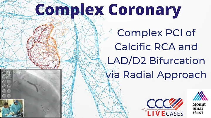 Complex PCI of Calcific RCA and LADD2 Bifurcation via Radial Approach - March 15, 2011 Webcast Video