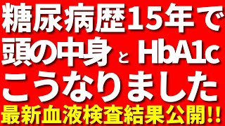 糖尿病を治す方法はある？私のスタンスと最新HbA1c公開