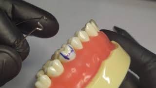 Adam clasp figure ( orthodontics removable appliances )