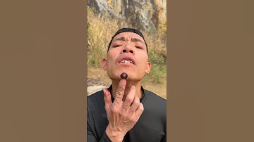 How I🤔😫😱 Cured a Bug Bite with Yogurt in the Wild Survival Hacks