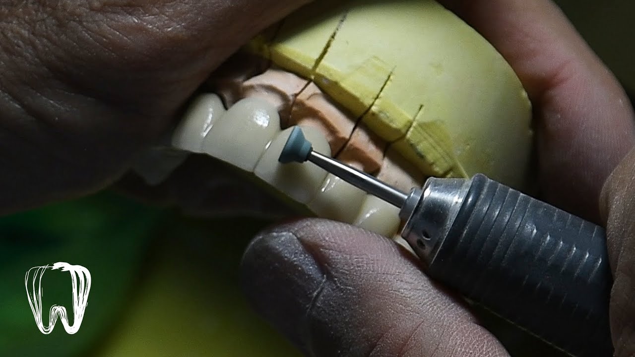 آموزش پودر گذاری دندانسازی/ PFM bridge start to finish 10 units