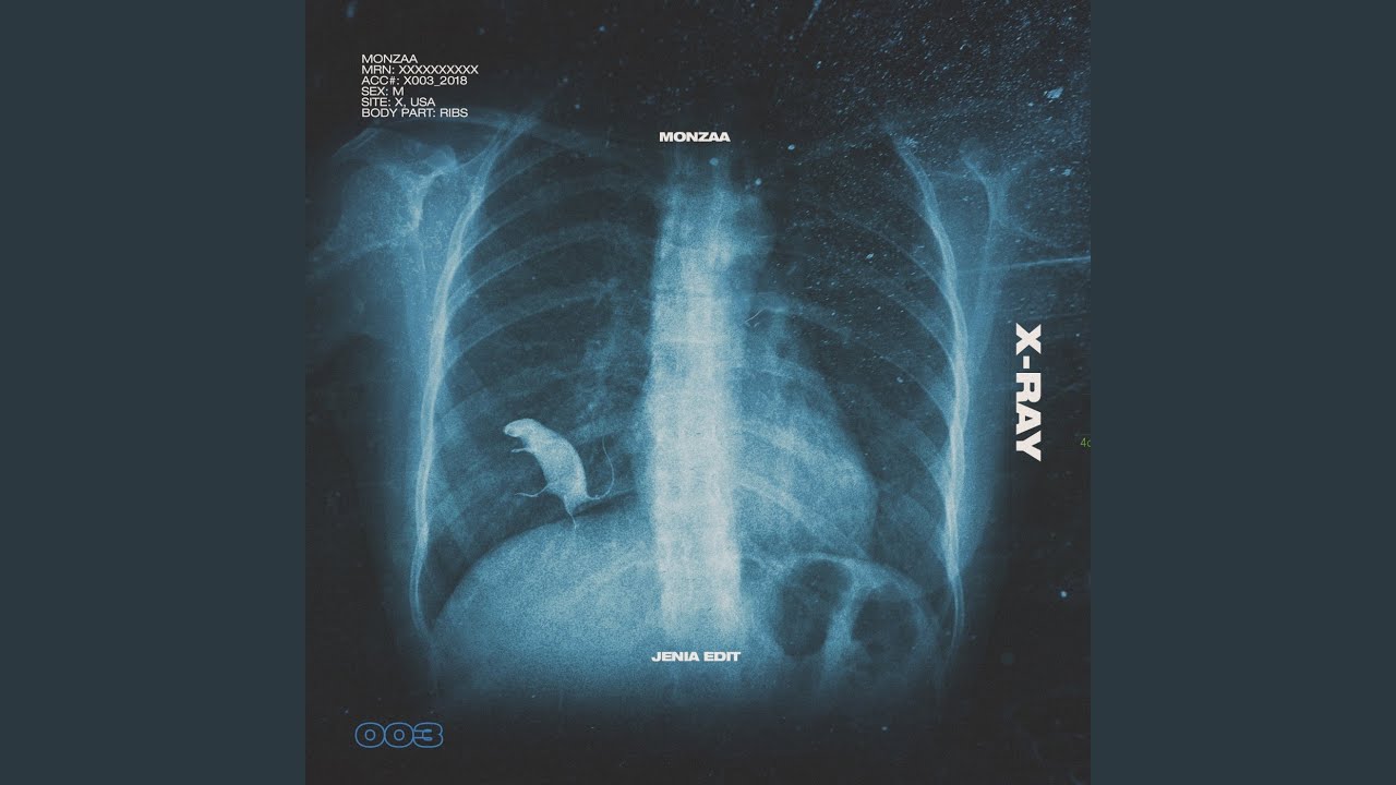 Sleduj X-Ray (Jenia Edit) na YouTube