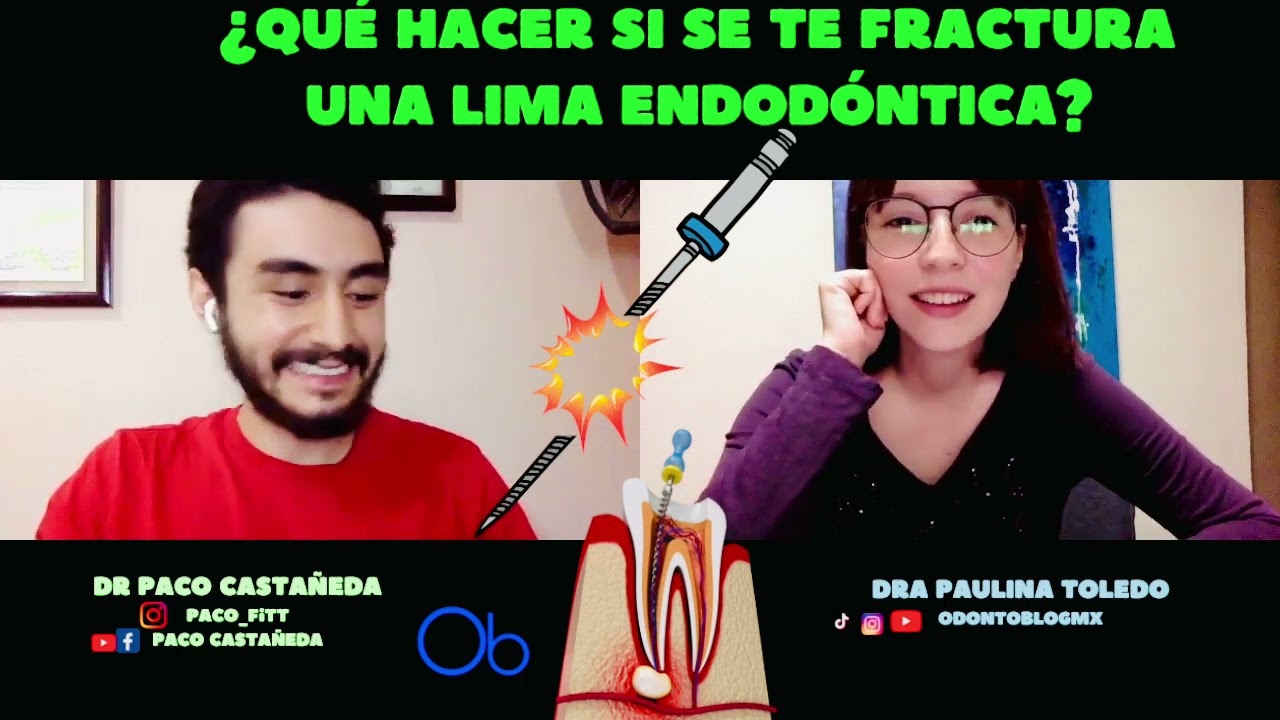¿Qué hacer si se me fractura una lima endodóntica? 🦷 