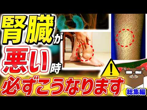 【危険】知らないと後悔する。足・皮ふ・目..「腎臓」が弱っていると起きる超意外な危険サイン。人工透析を避ける術は。こんな薬が腎不全の引き金を引く？「クレアチニン」とは何か。医師が完全解説【腎臓総集編】