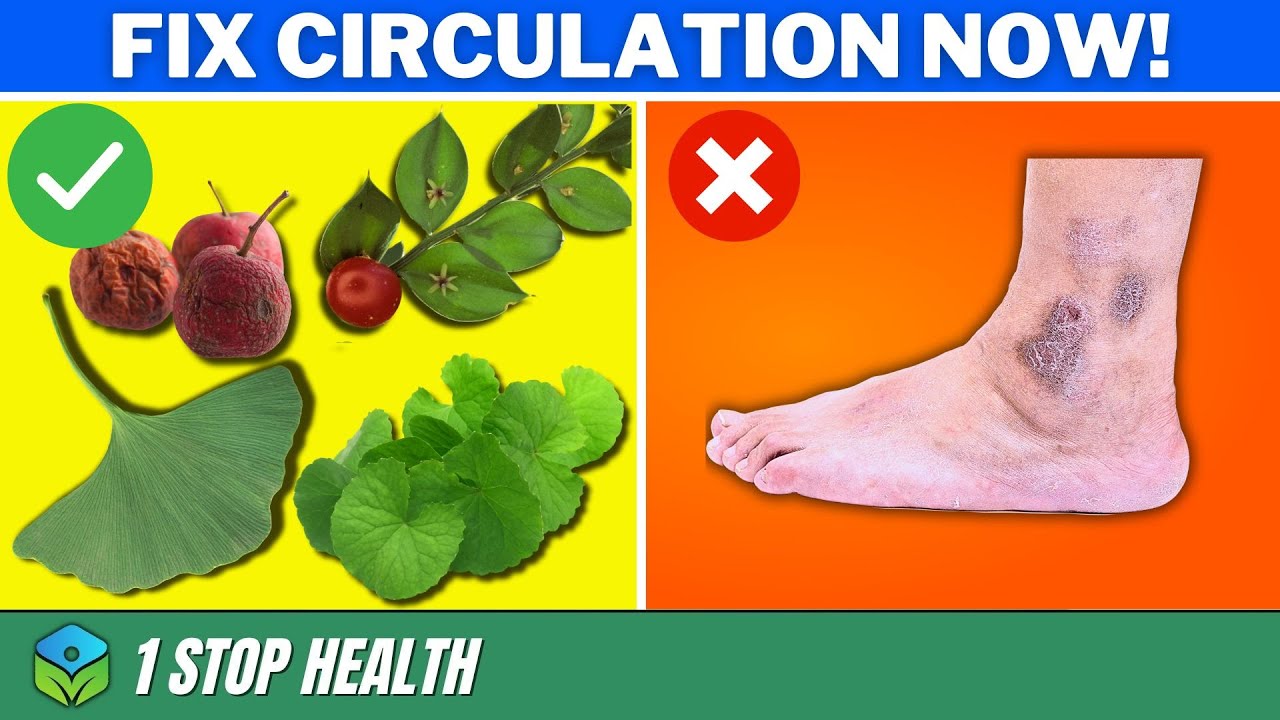 Boost Your Leg Circulation Top 9 Herbs For Better Blood Flow 1Stop boost-your-leg-circulation-top-9-herbs-for-better-blood-flow-1stop