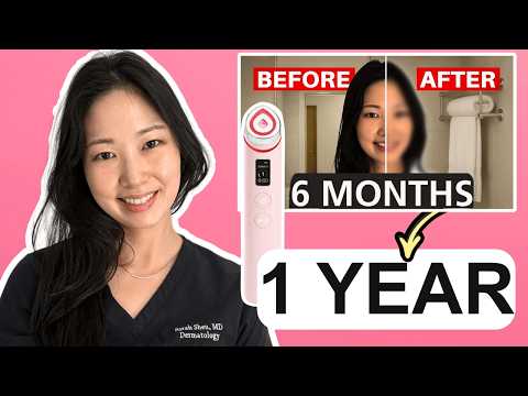 Dermatologist: 1 YEAR of using Medicube's Booster Pro