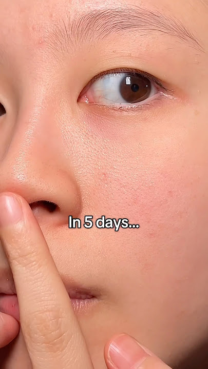 In 5 days pore minimizing brightening ampoule✨ SKIN1004