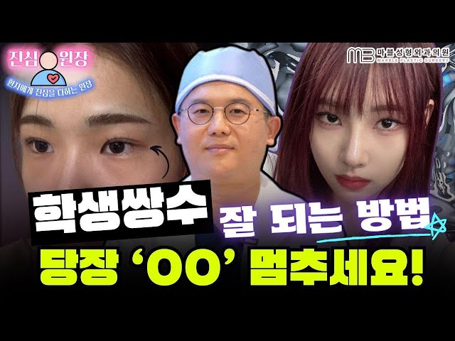 [성형외과 전문의 Q&A] 학생분들 쌍커풀수술 하기전에 '절대로' 하지 말아야할것