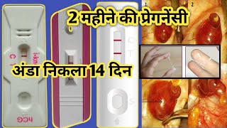 Ovulation bhi nahi samajh aaya, Pregnancy test bhi fail? Full guide!