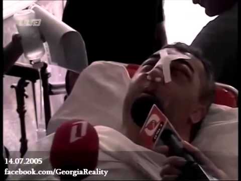 სასტიკად ნაცემი ვალერი გელაშვილი