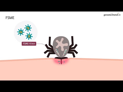Video: Ehrlichiose: Was Sie über diese durch Zecken übertragene Krankheit wissen sollten