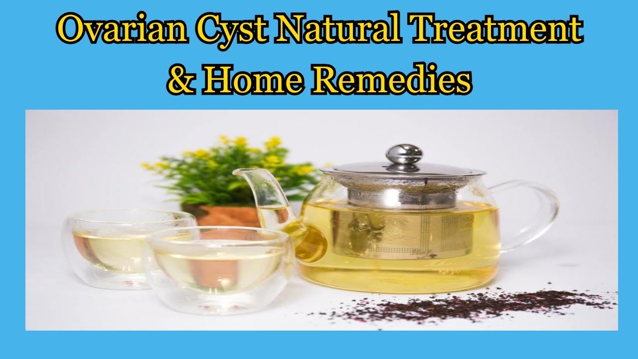 Ovarian Cyst Natural Treatment & Home Remedies YouTube