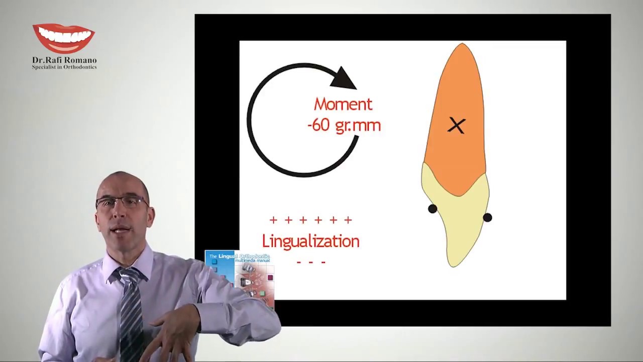 Dr. Rafi Romano - Lingual orthodontics biomechanics  1- center of resistance