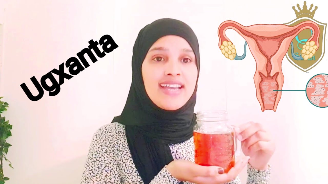 Ugxanta daalan ama daciifka ah gabdhahii so codsaden kafa idesi wacan