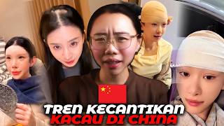 Obsesi 'Kepala Plastik' di China yang Bikin Geleng-Geleng Kepala