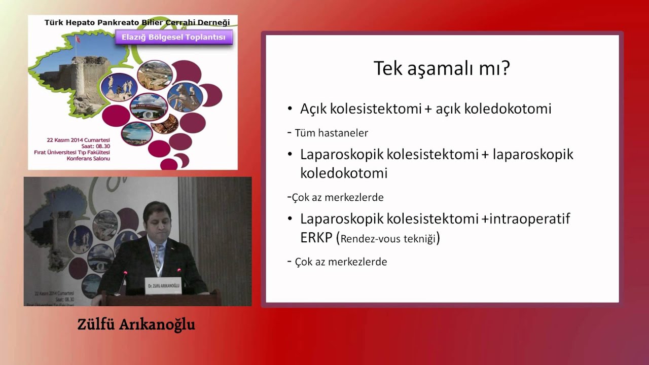 Safra Kesesi ve Koledok Taşlarında Cerrahi Tedavi Zülfü Arıkanoglu